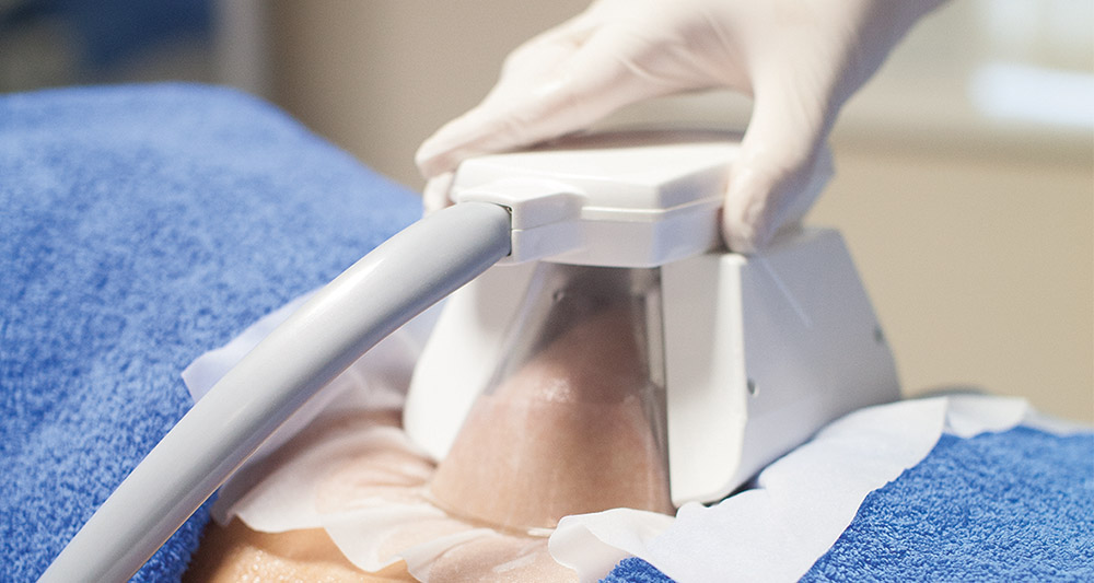 How Fat Freezing and HIFU Work Together? 2 Multiple Areas in One Session HIFU and Fat Freezing Dorset