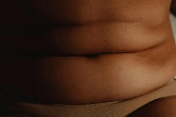 The Hidden Connection: How Stress Shapes Your Fitness and Body Composition 3 image of what stress can do on the stomach area and how Lipo 360 Dorset can help to change your body shape.
