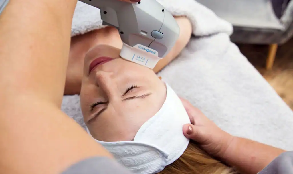 Discover the Perfect Duo: RF Microneedling and HIFU 1 Image of Morpheus8 And HIFU Dorset combined treatment